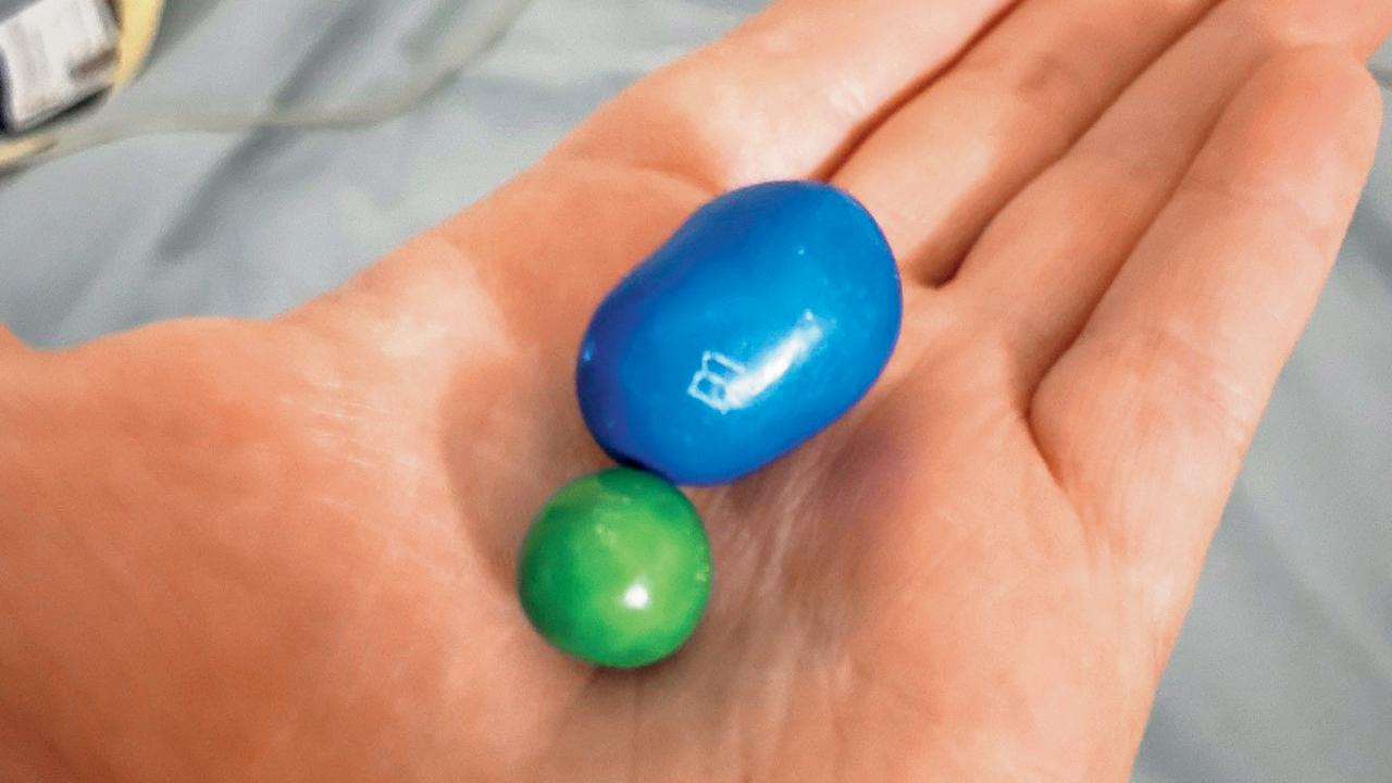 Man Claims To Have Found Biggest M&M, Guinness World Records