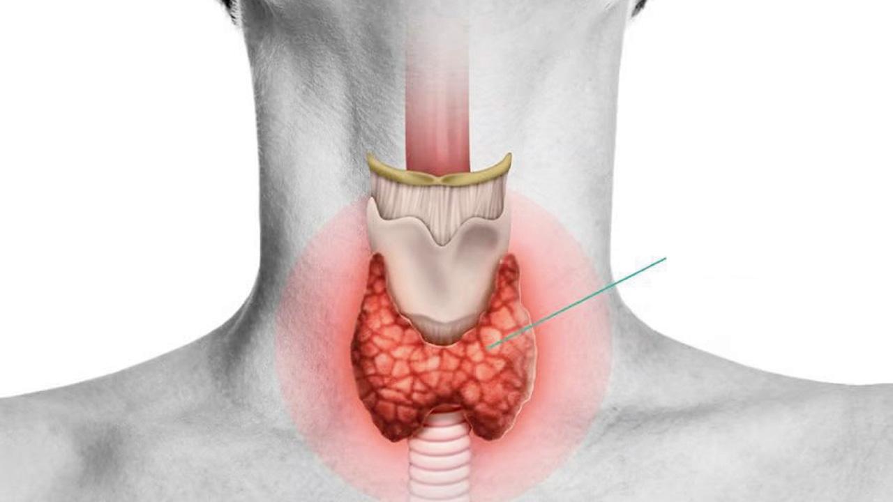 થાઇરૉઇડ ગ્રંથિ