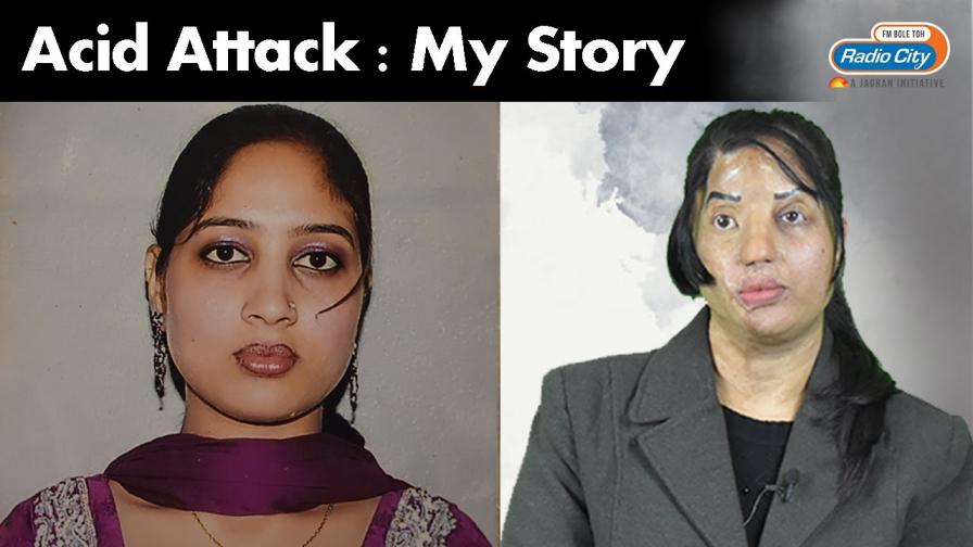 Acid Attack Survivor - Amanpreet Kaur 